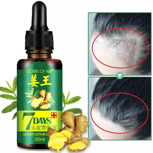 Original 7 Days Hair Growth Germinal Serum Oil 30ML | Hair Growth & Repair Serum