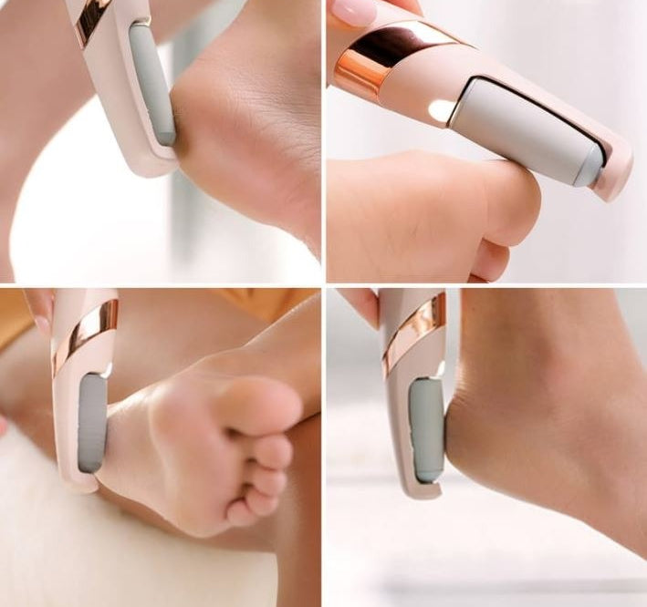 🦶 Rechargeable Electric Foot Callus Remover